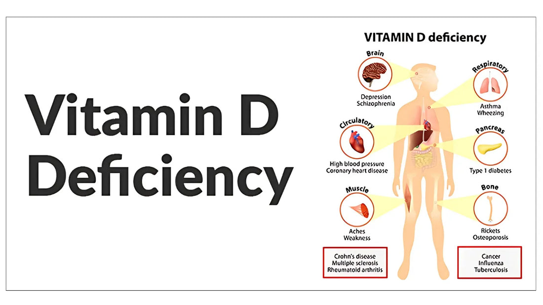 Vitamin D Deficiency