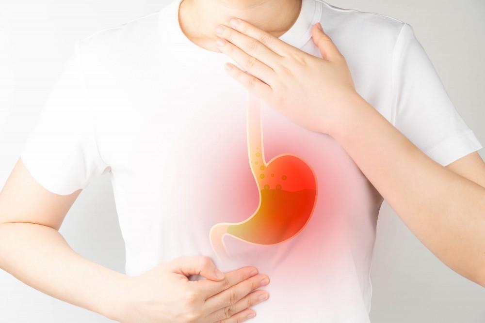 Acid reflux is where stomach acid travels up to your throat from your stomach. It can cause a burning feeling in your chest called heartburn.