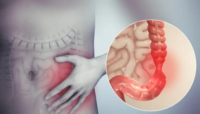 Bladder & Bowel