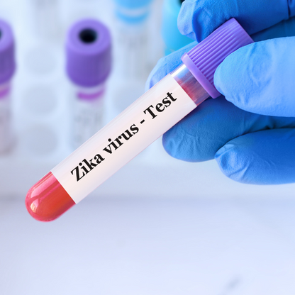 Zika Virus Antibodies Blood Test (Flavivirus)